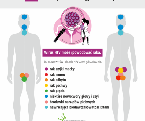 infografika
